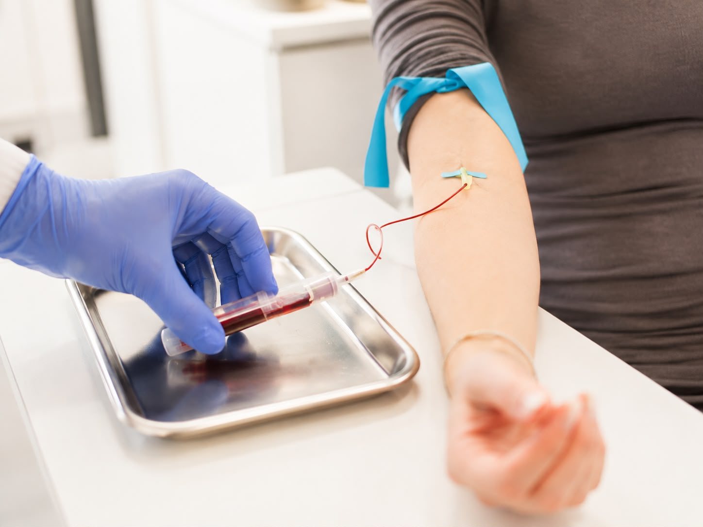 Blutentnahme zur Gewinnung von Eigenblut für die PRP-Behandlung
